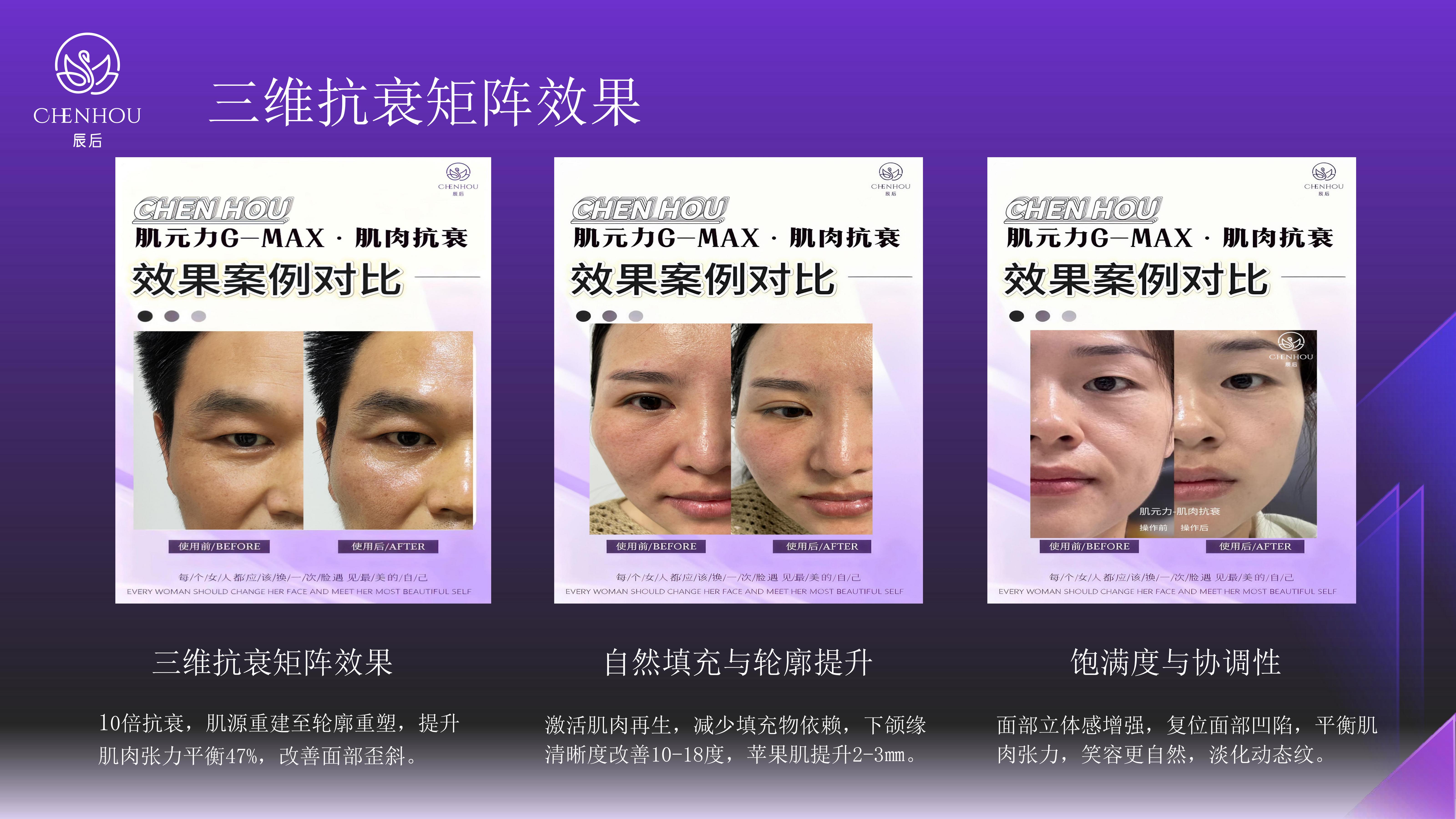 efbbdbc9f96e1f65987afdc717300710.jpg 辰后-肌元力项目企划书_20.jpg